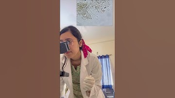 Fungal KOH mount for Onychomycosis!#dermatologist #derma #fungusinfection