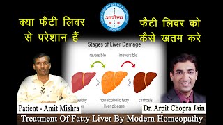 Liver Cirrhosis & Fatty Liver Cured by Dr.Arpit Chopra Jain's Aarogya Modern Homeopathy in 1 month