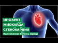 Инфаркт миокарда. Стенокардия. Ишемическая болезнь сердца.