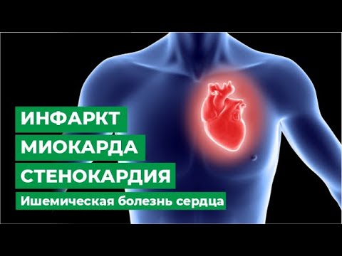 Видео: Может ли болезнь сердца вызвать инфаркт миокарда?