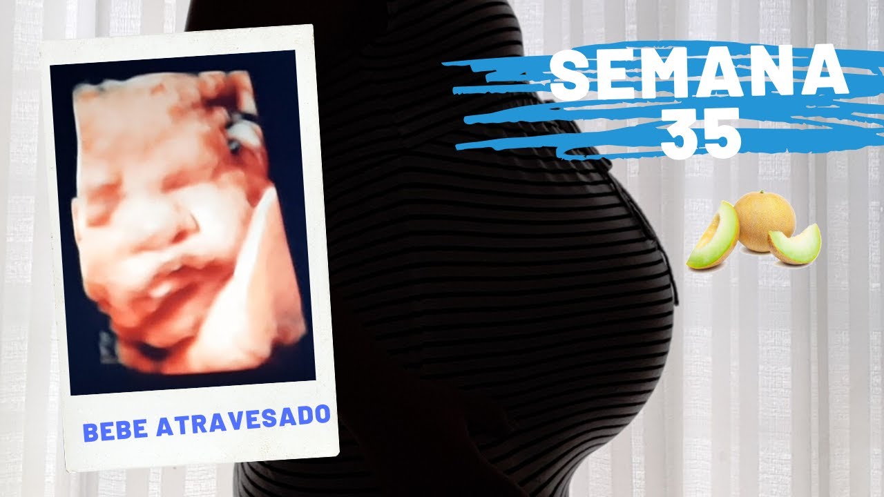 Semana 35 De Embarazo El Bebe Esta Atravesado Youtube Semana 35 De Embarazo El Bebe Esta Atravesado Youtube