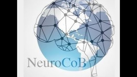 Voxel based morphometry and seed based analysis of resting state fMRI in Alzheimer