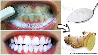 Teeth whitening in just 2 minutes - how to whiten teeth at home 100% effective