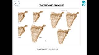 FRACTURAS Y LUXACIONES DEL MIEMBRO SUPERIOR I