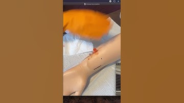 AV Fistula Needle Insertion Cannulation Demo/Procedure