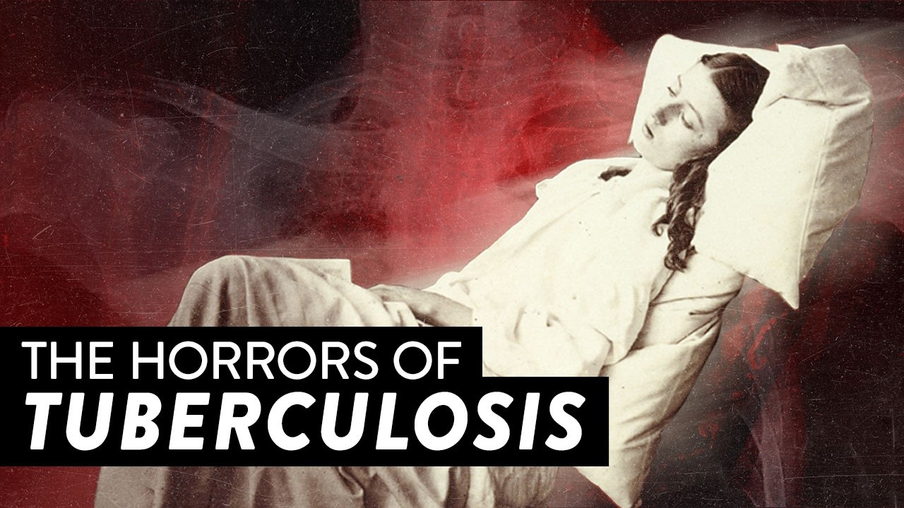 How Tuberculosis Slowly Destroys You