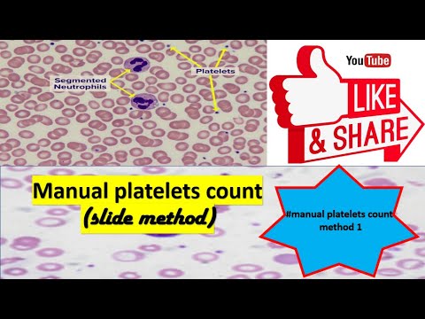 Manual platelets count - YouTube