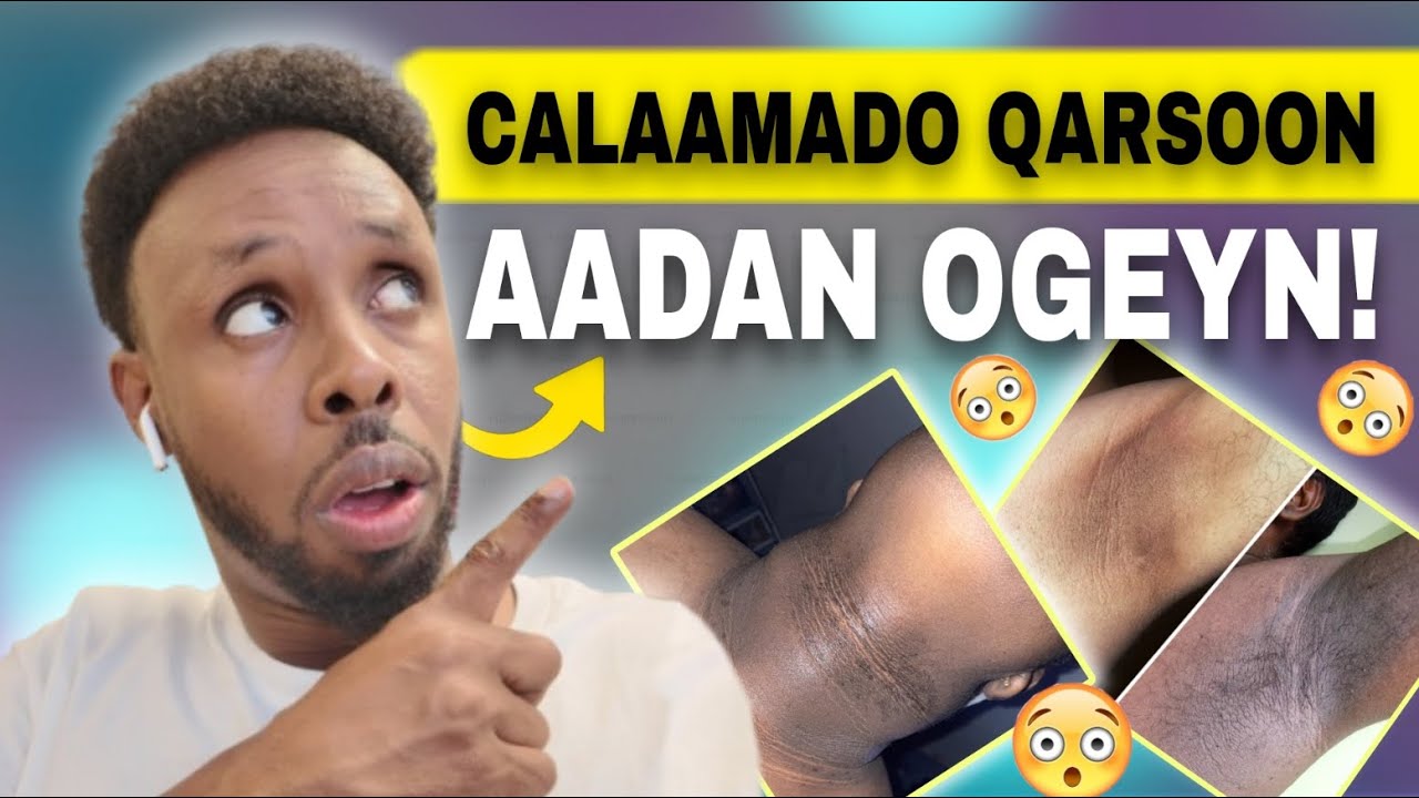 13 Calaamadood In Jidhkaagu Bukaan Yahay (Hubi Hadda!)