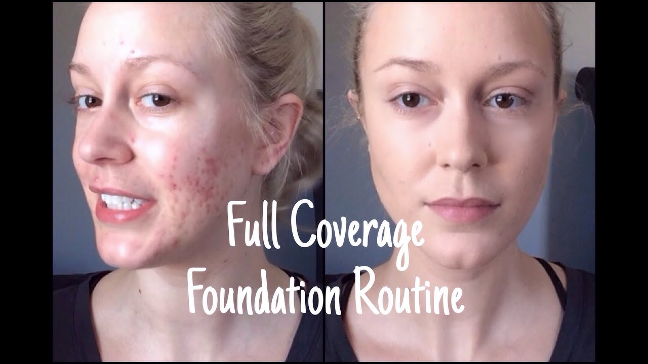 Full Coverage, Acne Covering Foundation Routine!