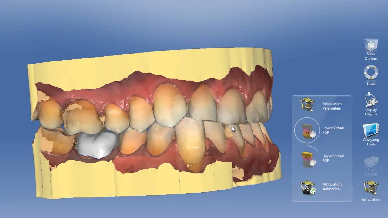CEREC Articulation