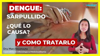 🟢 RASH y PICAZÓN en el DENGUE: POR QUÉ OCURRE y CÓMO HACER que DESAPAREZCA 🦟