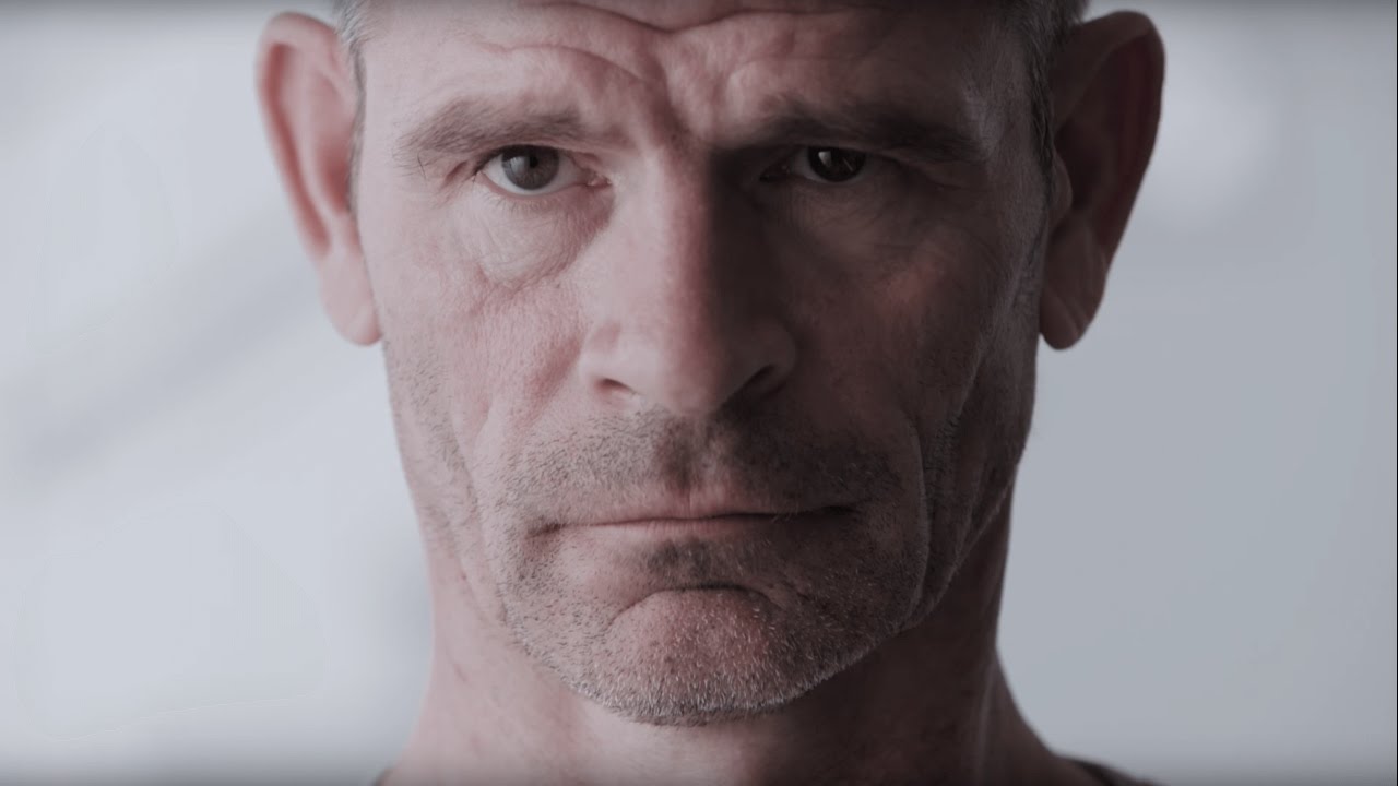 RHEO KNEE® XC by Össur