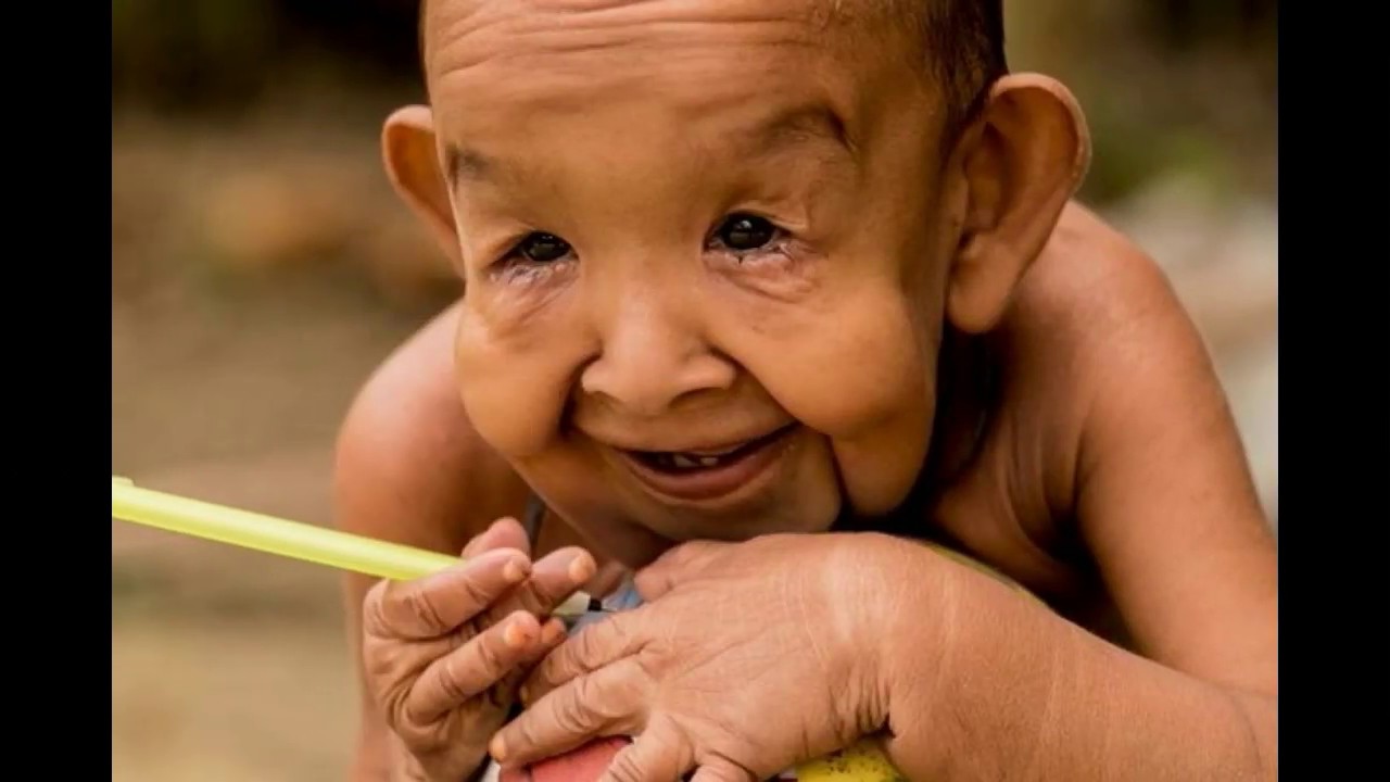 A child who looks like me. психологическая карликовость. Yippee autism. Looking like a child. Oliver tree раньше и сейчас.