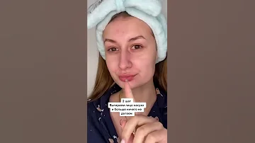 Как определить тип кожи? Самый ПРОСТОЙ метод