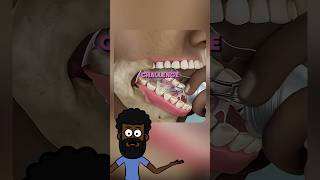 How A Light Bulb Can Trap Your Jaw