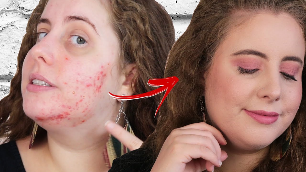 COMO ESCONDER MANCHAS DE ESPINHA COM MAQUIAGEM - PELE COM APARÊNCIA NATURAL!