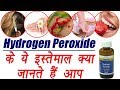 Hydrogen Peroxide: Beneficial Uses at home, ऐसे करें घर में हाइड्रोजन पेरोक्साइड का इस्तेमाल|Boldsky