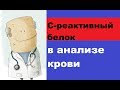 В крови повышен С-реактивный белок: причины