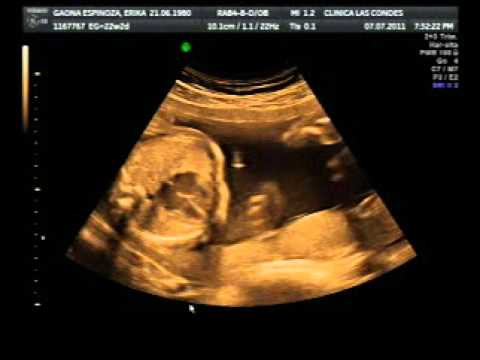 Ecografia la para obstetrica doppler que sirve