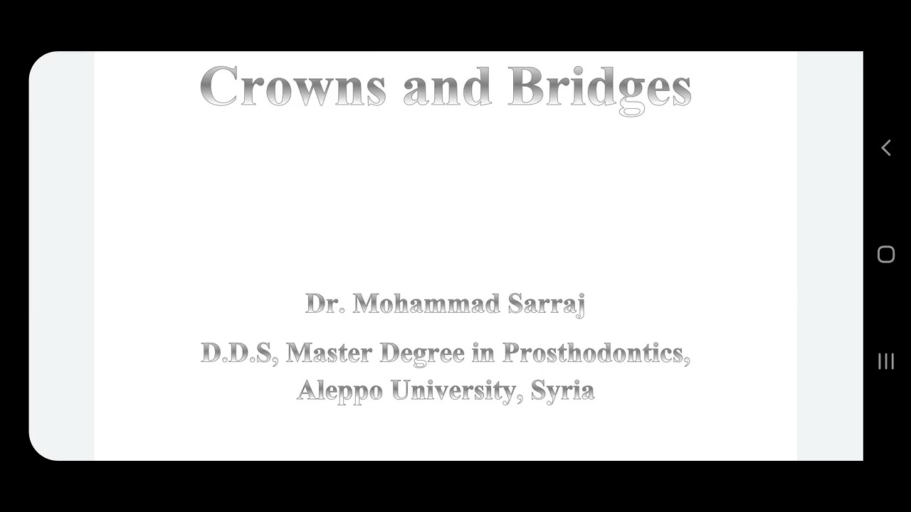 خطة المعالجة و تحضير الدعامات للتيجان و الجسور . د محمد سراج