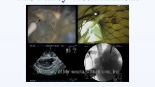 Testing Your Medical Device Idea: Bench Tests, Animal Tests and  Reimbursement (Prof. Paul Iaizzo )