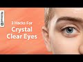 3 Hacks For Clear White in the Eyes l Sparkling White Eyes, DIY Heated Eye Pads