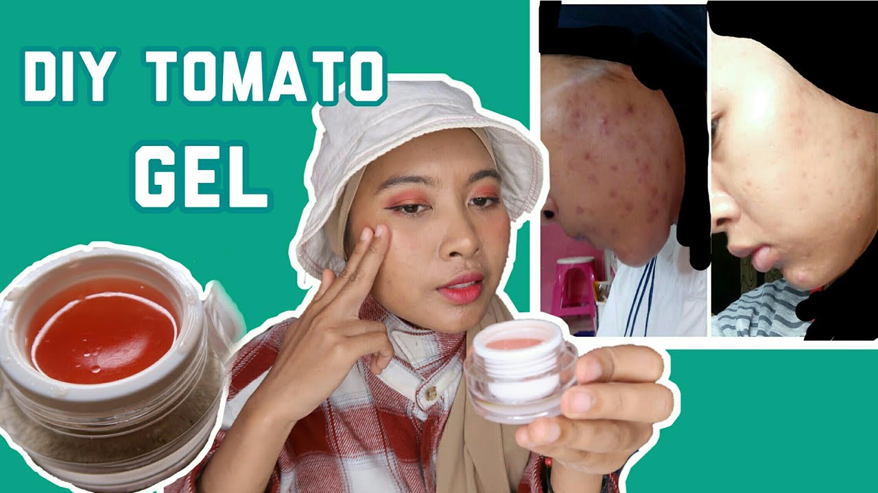 CARA MENGHILANGKAN JERAWAT dan BRUNTUSAN DENGAN GEL TOMAT  