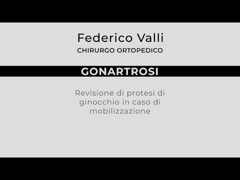 Video: Influenza Della Lunghezza E Del Diametro Dello Stelo Di Estensione Sugli Esiti Clinici E Radiografici Dell'artroplastica Totale Di Revisione Del Ginocchio