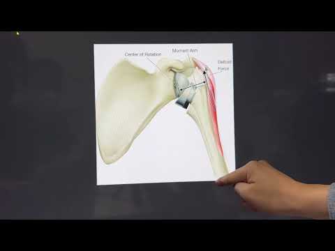   삼각근의 모멘트암과 Force 임상적의미