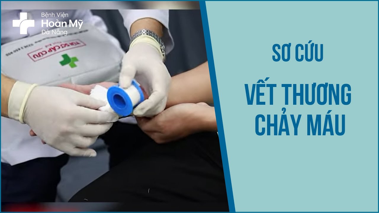 [Hướng dẫn sơ cấp cứu] Sơ Cứu Vết Thương Chảy Máu - Bệnh viện Hoàn Mỹ Đà Nẵng