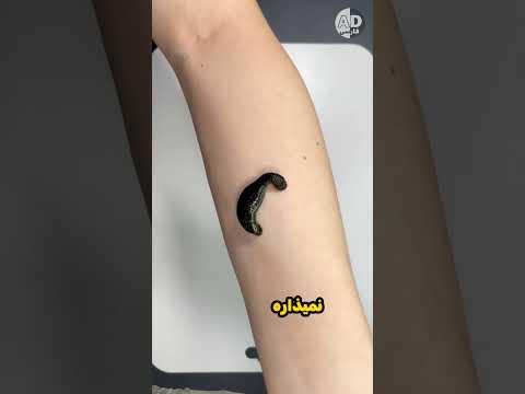زالوها چطور خون می مکند بدون اینکه احساسش کنید