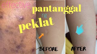 Effective Peklat Remover|| Pampawala o Pantanggal ng Peklat na Mura