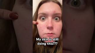 Someone Fix My Skin Please