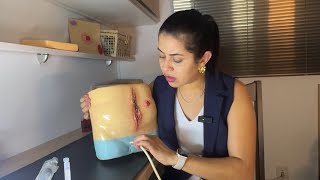 ATUALIZAÇÕES SOBRE A SONDA VESICAL DE DEMORA (volume e teste) E CISTOSTOMIA
