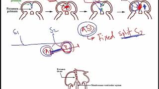 USMLE ACE Video 112: Embryonic development of atrial septum and ventricular septum