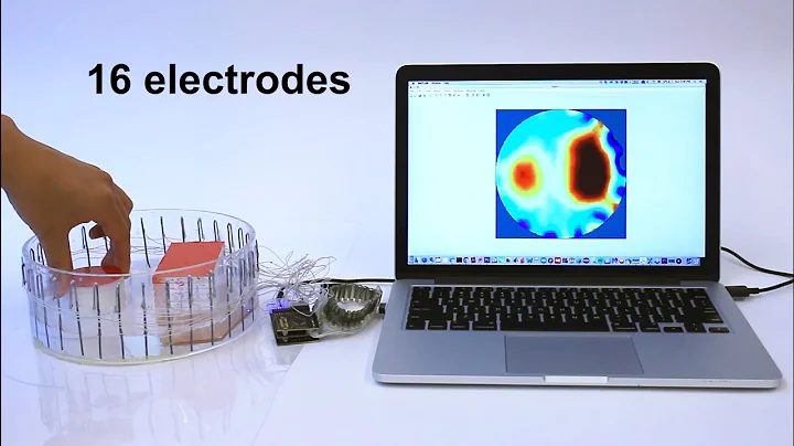 Advancing Hand Gesture Recognition with High Resolution Electrical Impedance Tomography