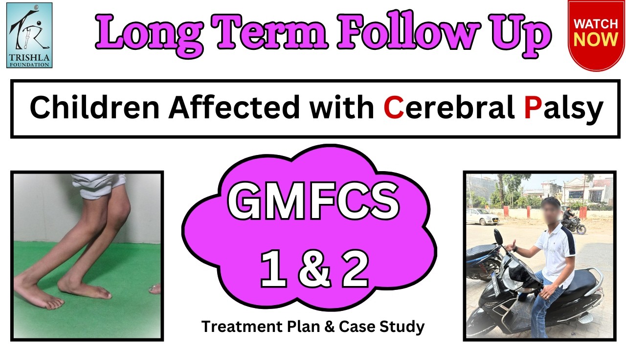 Long-term outcome in children with cerebral palsy who walk with little support