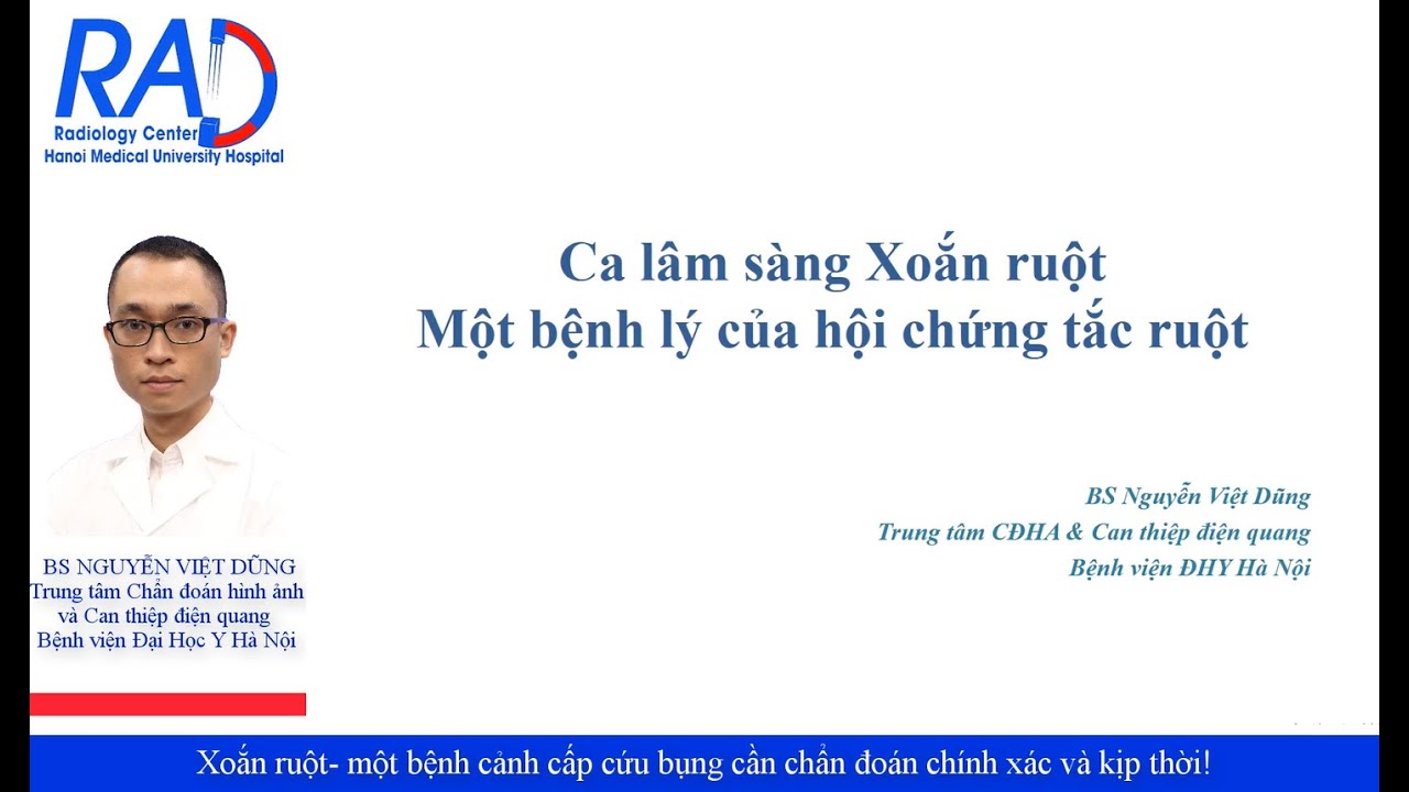 Xoắn ruột- một bệnh cảnh cấp cứu bụng cần chẩn đoán chính xác và kịp thời!