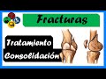 FRACTURAS - Tipos, CONSOLIDACIÓN y TRATAMIENTO