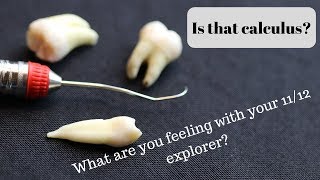 What are you feeling with the 11/12 explorer?