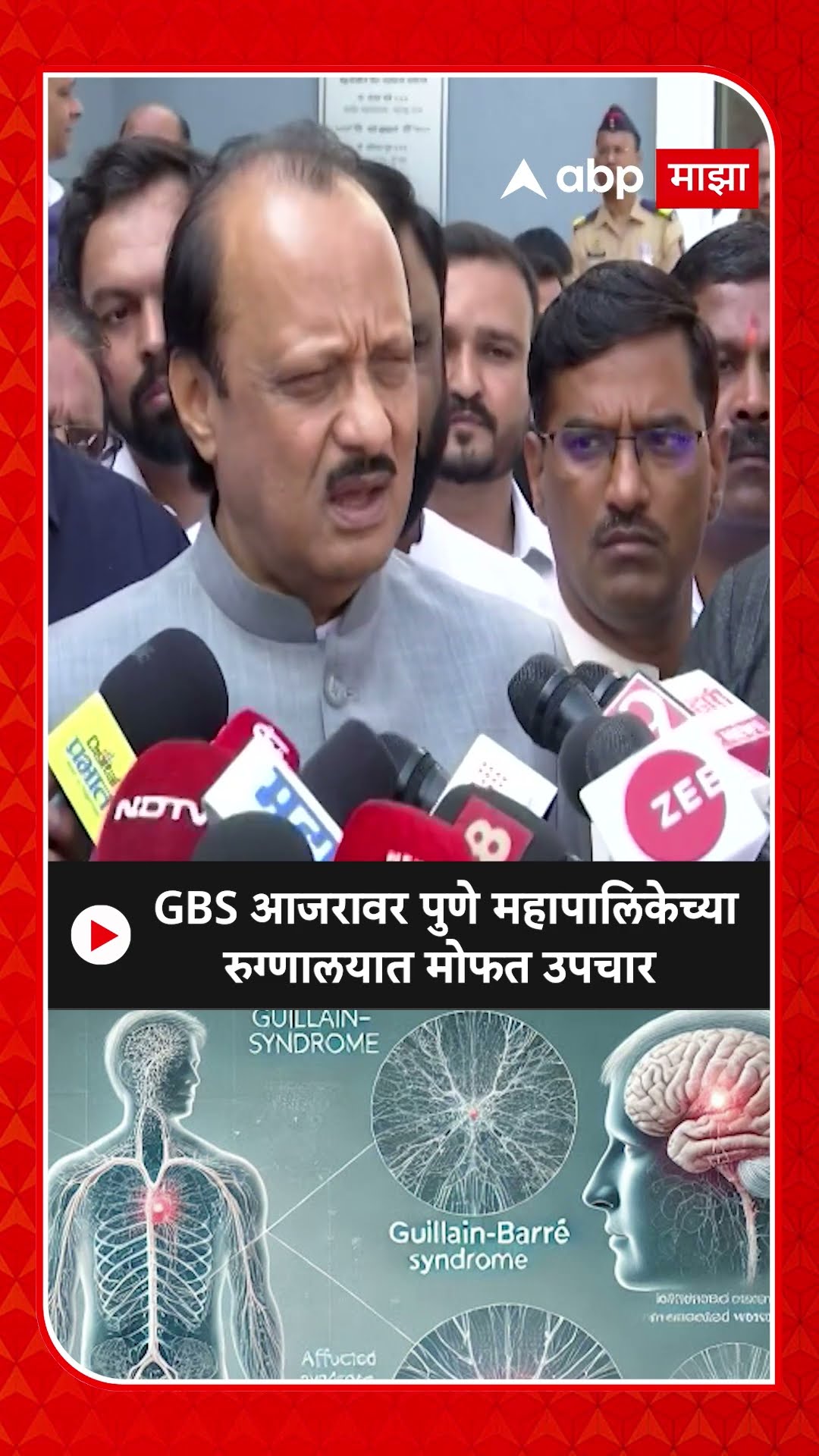 Ajit Pawar On GBS : GBS आजरावर पुणे महापालिकेच्या रुग्णालयात मोफत उपचार