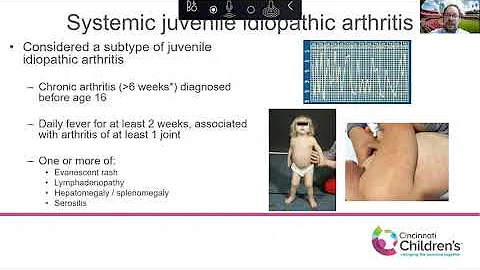 "Chronic Lung Disease in Systemic Juvenile Idiopathic Arthritis" by Grant Schulert, MD, PhD