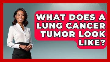What Does A Lung Cancer Tumor Look Like? - Oncology Support Network