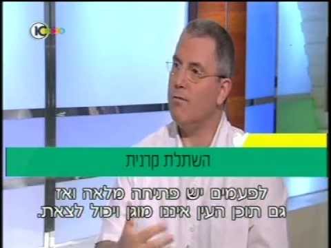 הכל על השתלת קרנית