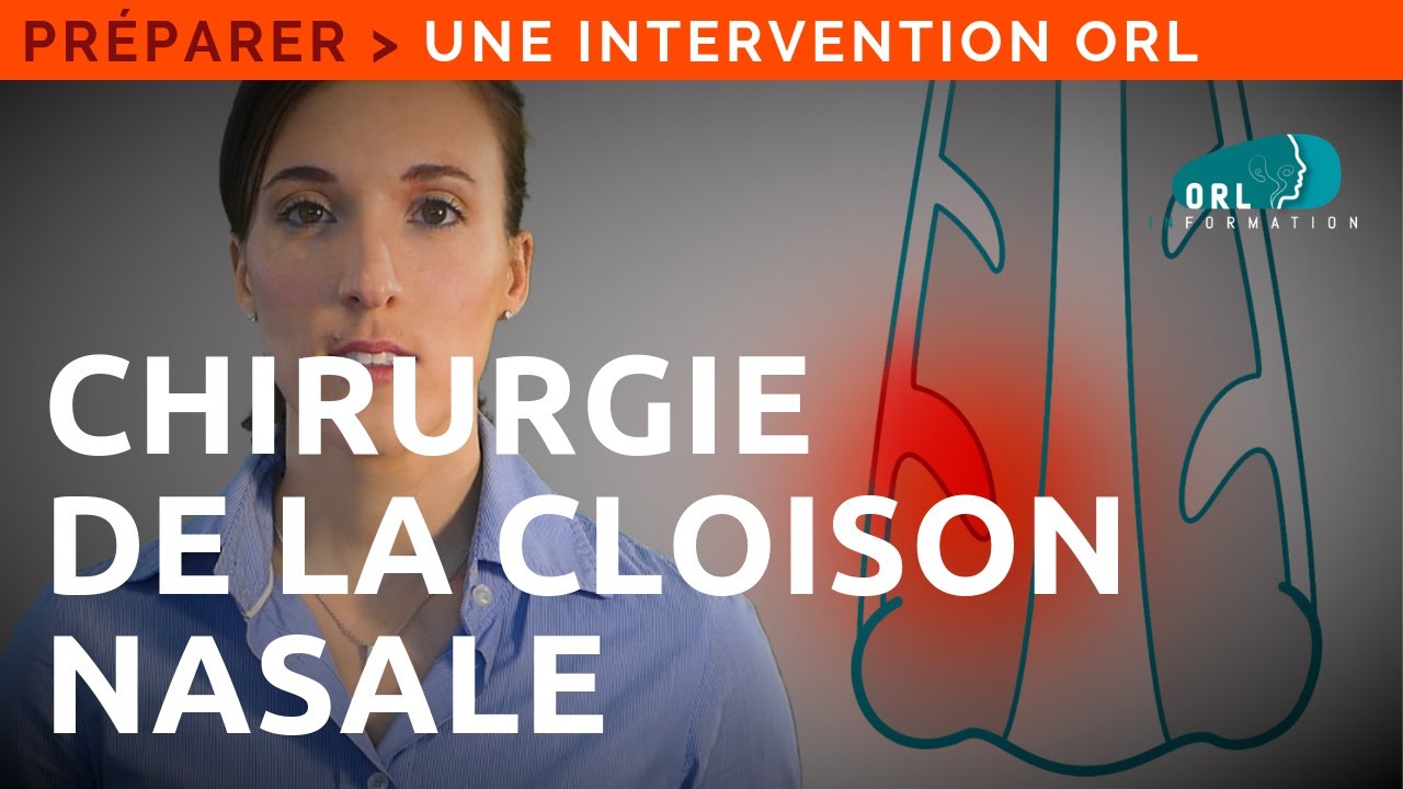 Chirurgie de la cloison du nez (septoplastie) Information Patient ORL