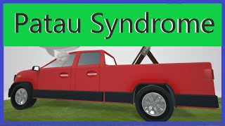 Patau Syndrome Mnemonic For The Usmle