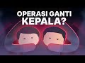 Mimpi Gila Sains untuk Operasi Ganti Kepala