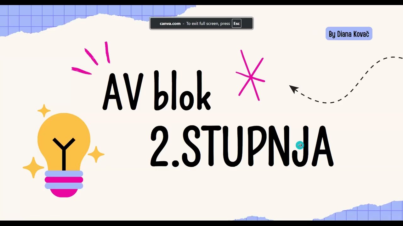 12.EKG: AV blok 2.stupnja (Mobitz 1 i Mobitz 2)