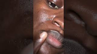 Seoul 1988 Retinal Liposome Serum