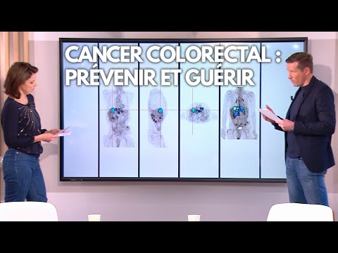 Vidéo: Causes, Risques, Traitement, Prévention Du Cancer Colorectal, Etc